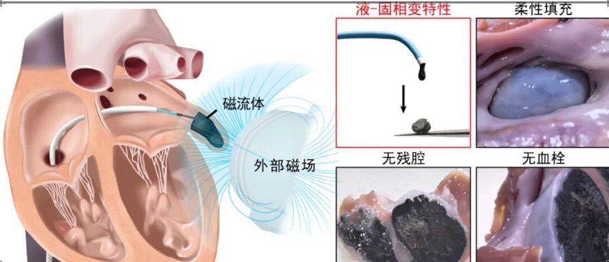 国家心血管病中心携手中科院在《Nature》发布磁流体封堵技术——宣告实现心脏在体3D打印梦想