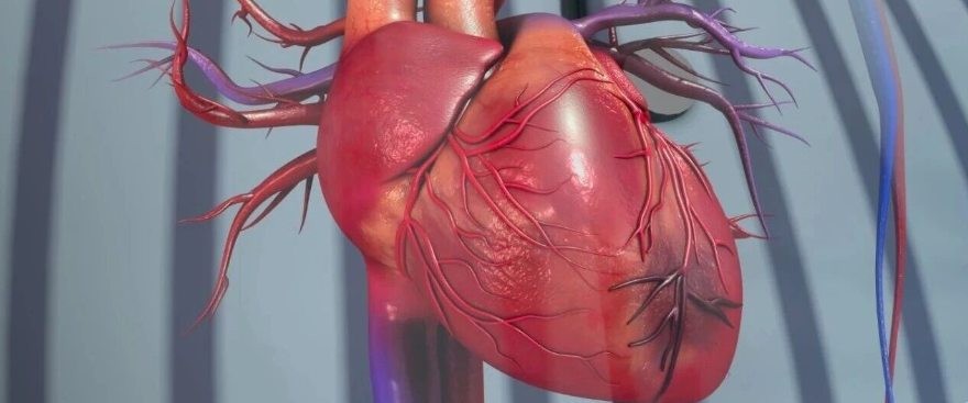 STEMI合并急性心衰识别与急救要点