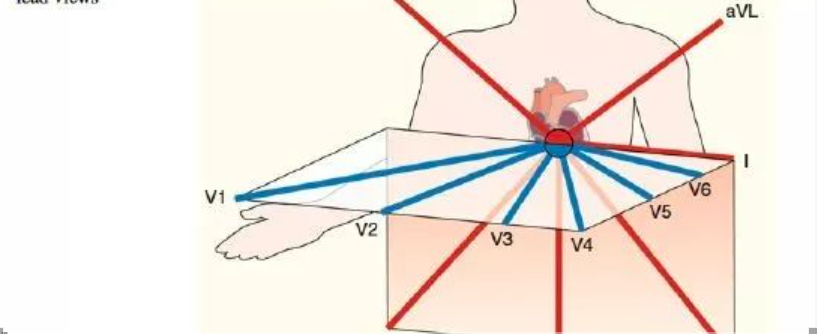  教你用最简单方法学习心电图！