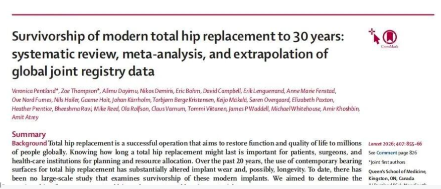 柳叶刀：92%的人工髋关节可以用30年！