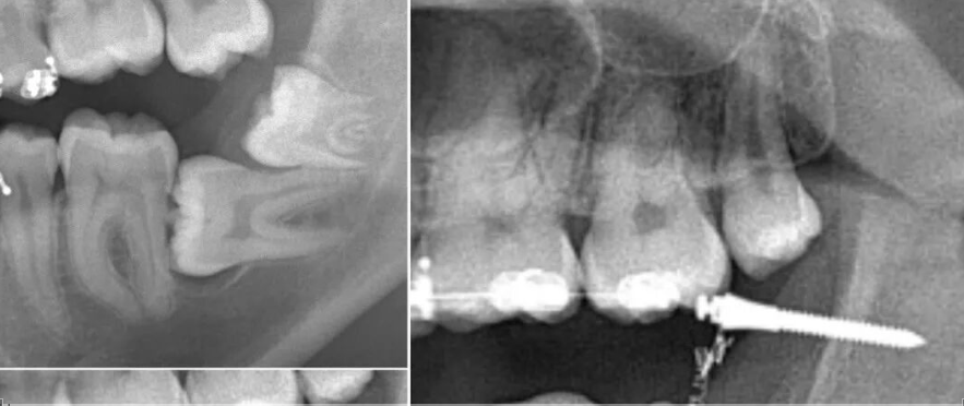 一位顶尖牙医的处理，思路是亮点