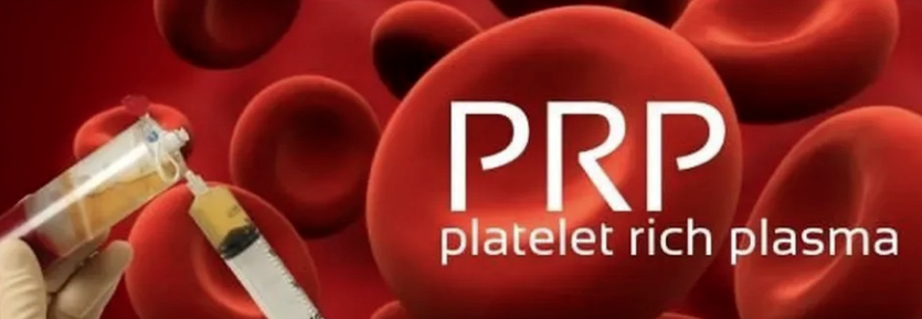 它山之石 | 自体单采富血小板血浆关节腔注射治疗膝骨关节炎的专家共识