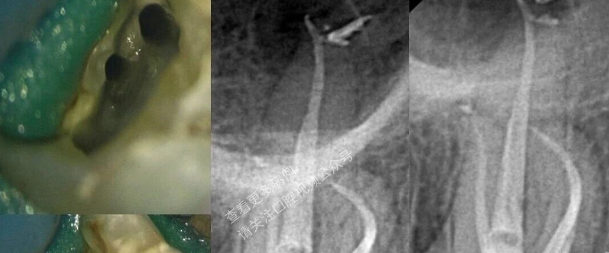 技巧，这样寻找MB2，你认可吗？