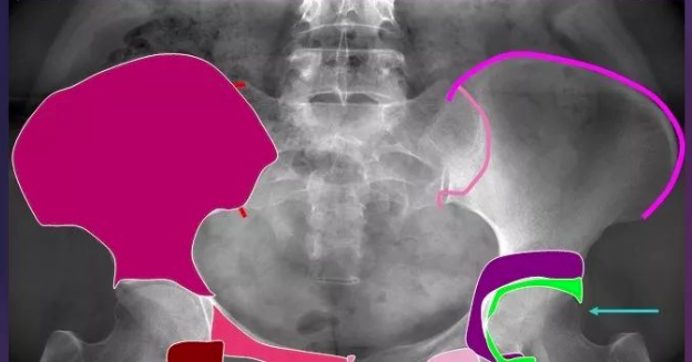 全身骨肌系统正常影像解剖（高清图谱）