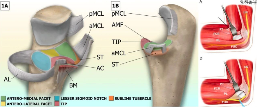 冠突骨折的解剖特点、分型与6种内侧手术入路