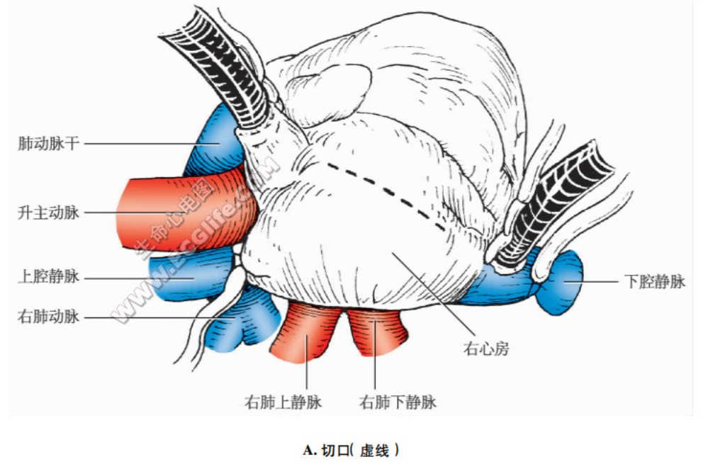 下腔静脉瓣图片