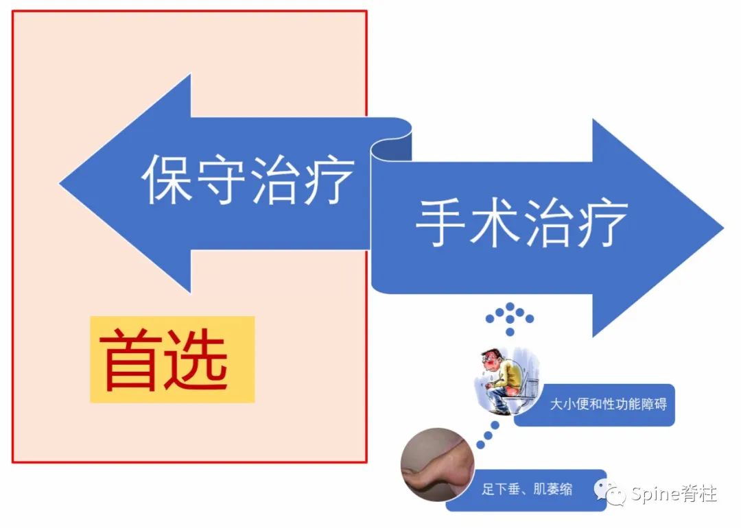 关于腰椎间盘突出症