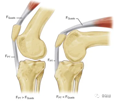 膝关节生物力学，看完本文你就理解了！