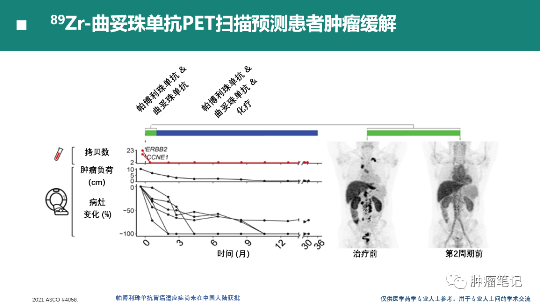 2021年胃癌免疫治疗最新进展