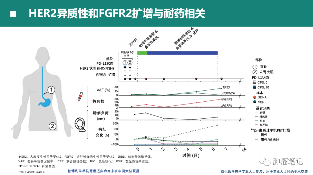 2021年胃癌免疫治疗最新进展