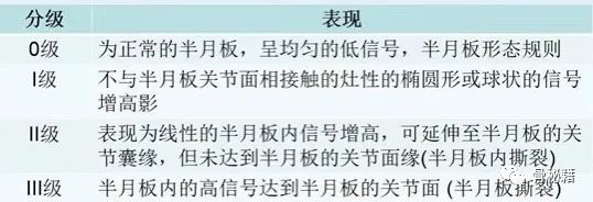 关于半月板损伤，一篇总结到位！