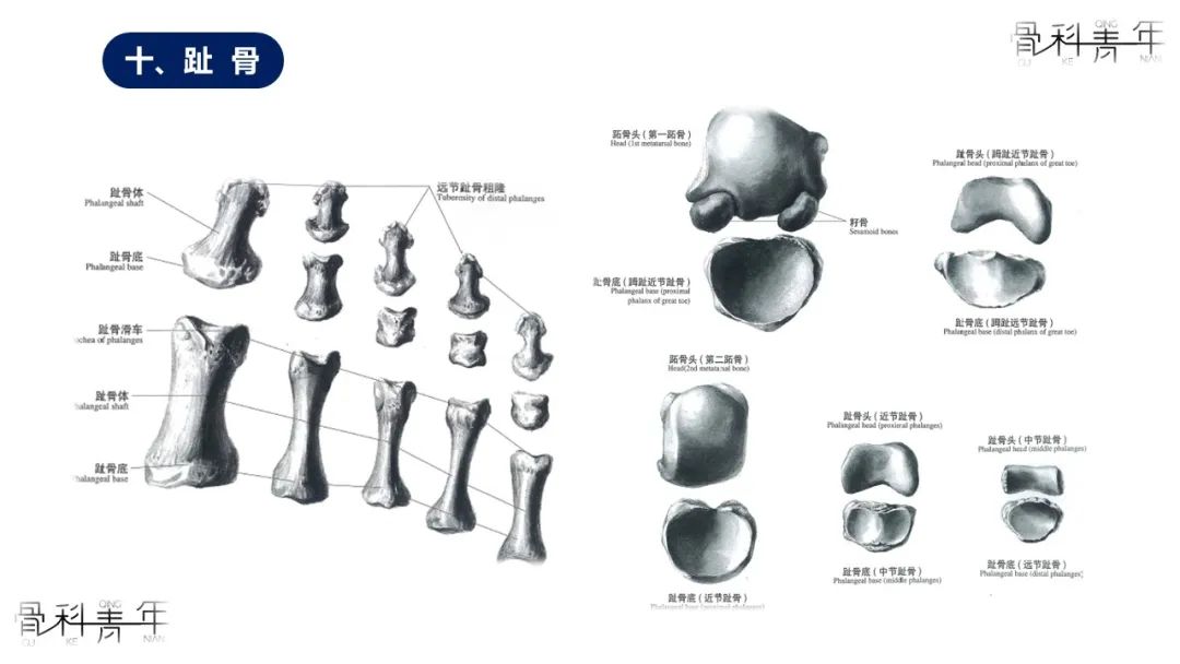 多图详解足部骨性解剖与常见副骨，速收藏！