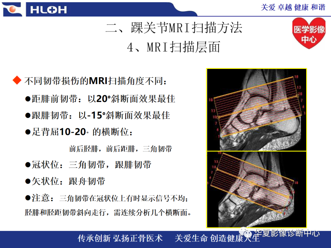 踝关节病变的MRI诊断