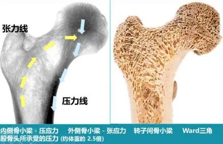 股骨粗隆间骨折PFNA内固定的4大关键