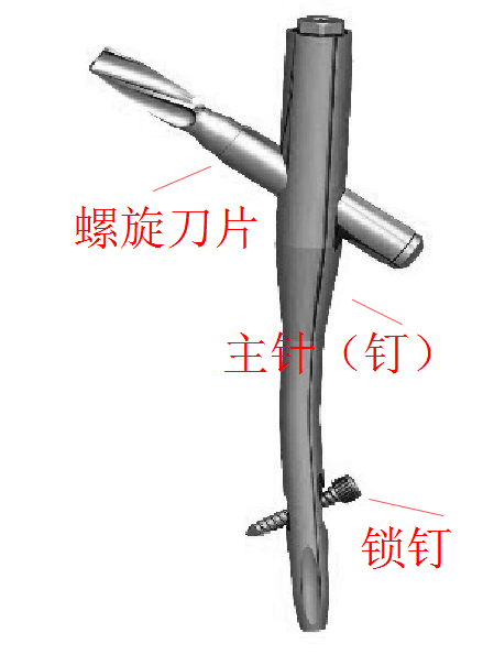 股骨粗隆间骨折PFNA内固定的4大关键