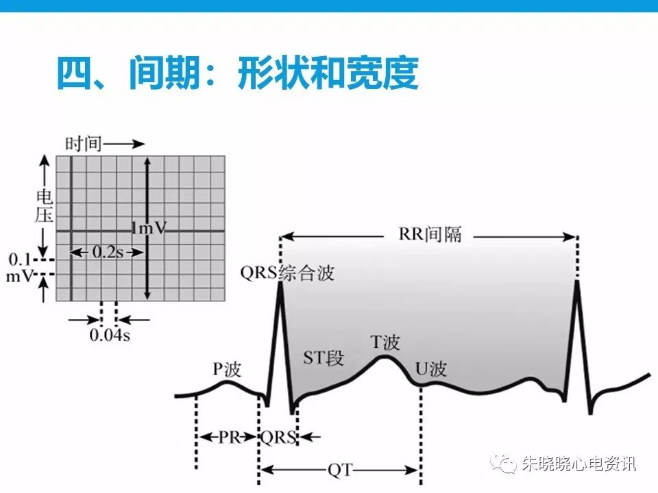 心电图评估5步法