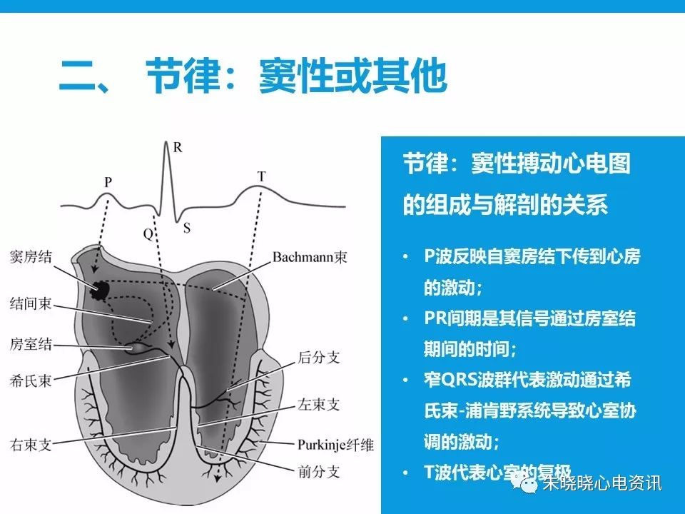 心电图评估5步法