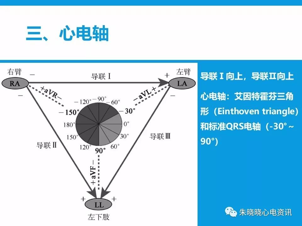 心电图评估5步法