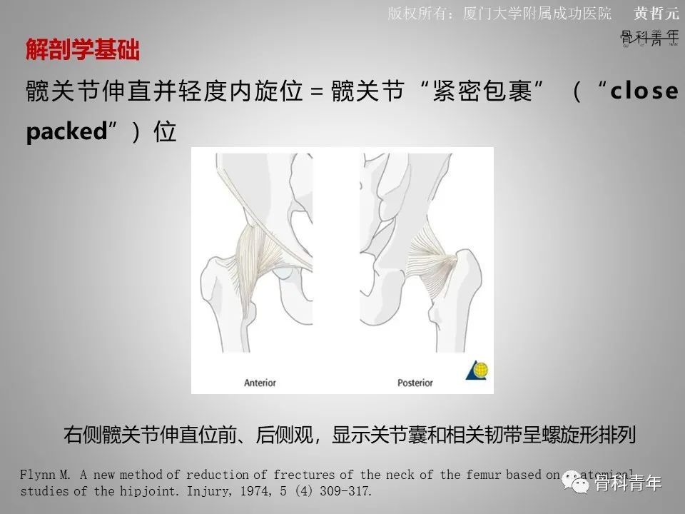 一文掌握股骨颈骨折的分型、复位与内固定！