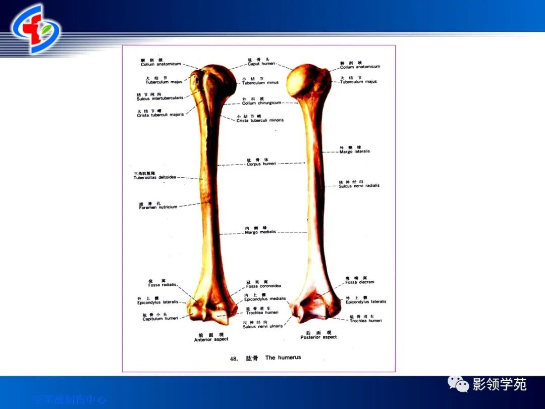 10种上肢骨折的影像学表现