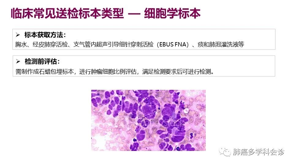 中国非小细胞肺癌分子病理检测临床实践指南解读