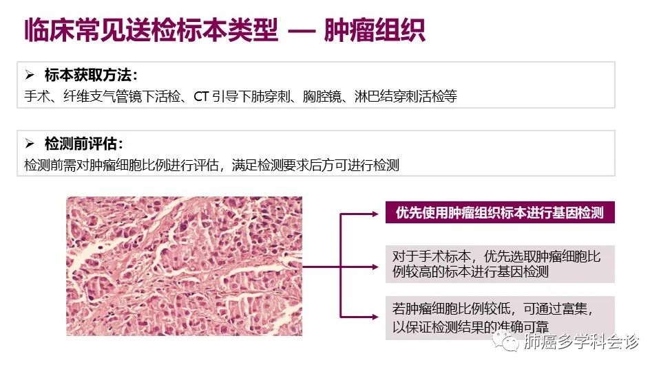 中国非小细胞肺癌分子病理检测临床实践指南解读