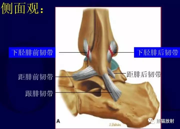 踝关节的韧带解剖及损伤表现