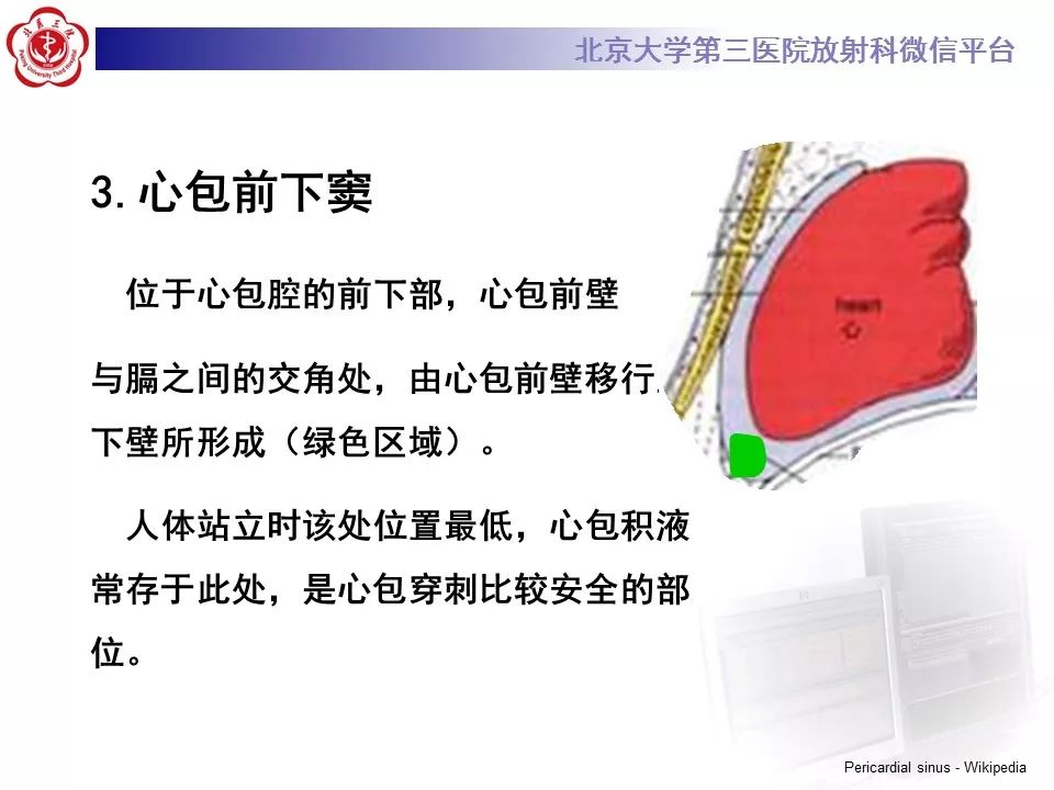 心包窦及心包隐窝的解剖结构（内附CT断层图解）