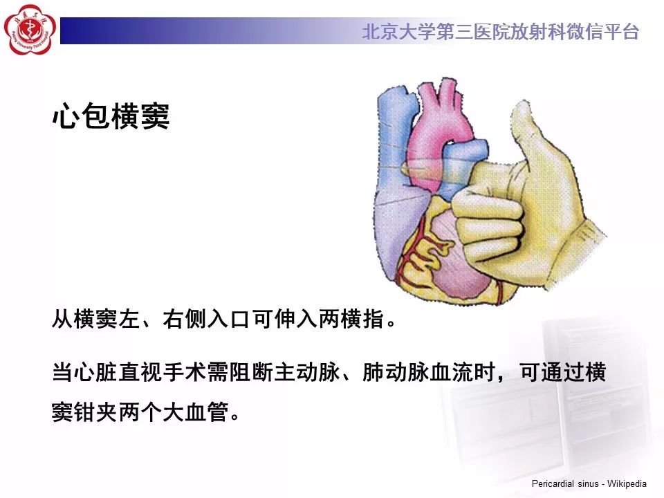 心包窦及心包隐窝的解剖结构（内附CT断层图解）