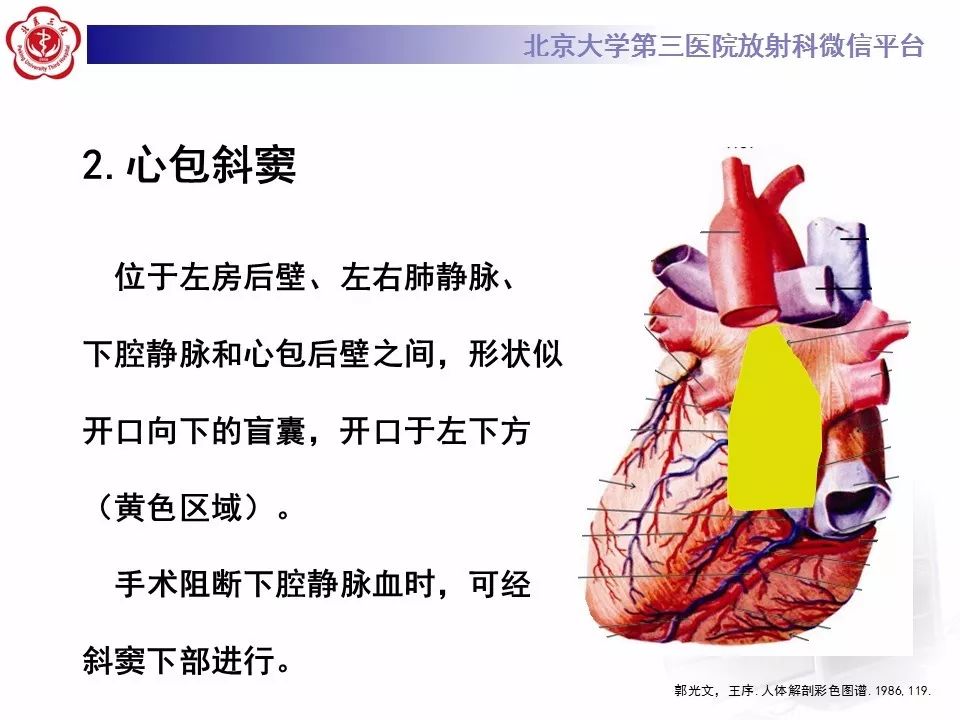 心包窦及心包隐窝的解剖结构（内附CT断层图解）