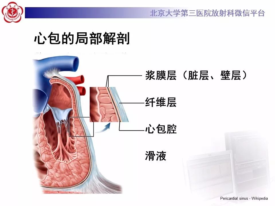 心包窦及心包隐窝的解剖结构（内附CT断层图解）