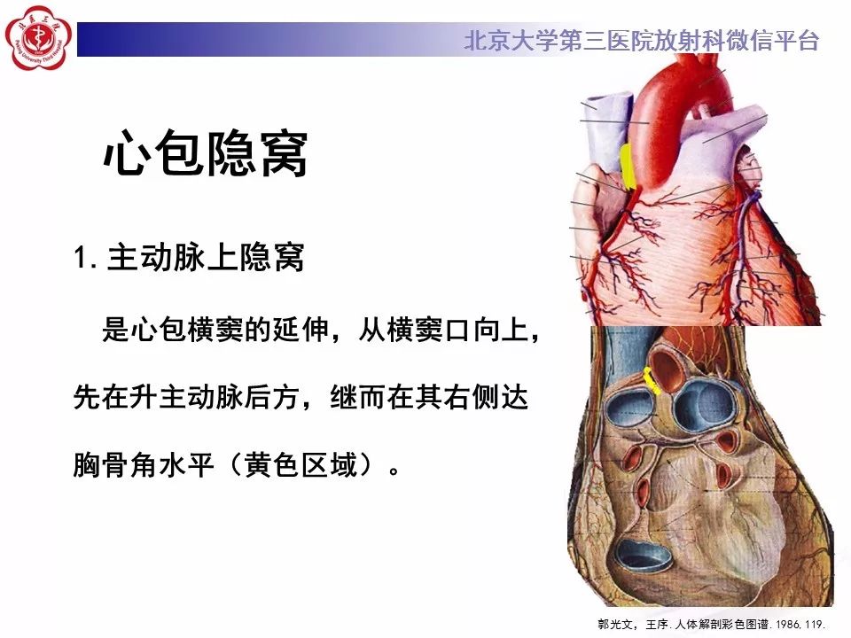 心包窦及心包隐窝的解剖结构（内附CT断层图解）