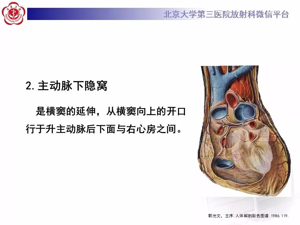 心包窦及心包隐窝的解剖结构（内附CT断层图解）