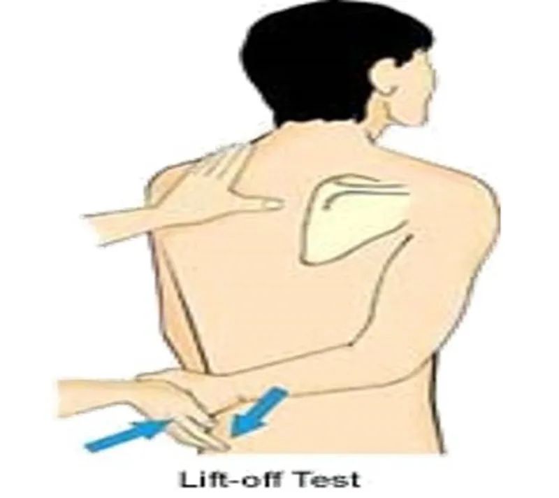 一篇掌握肩袖损伤的诊断与治疗