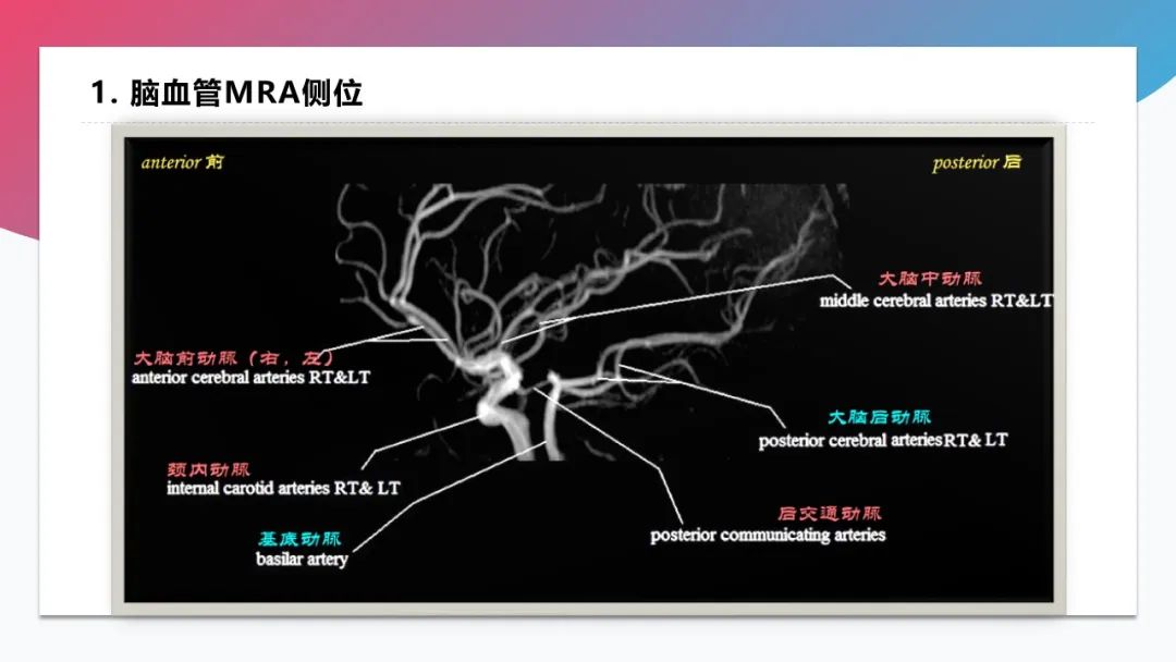 脑血管解剖学习总结