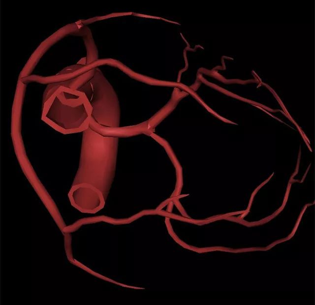 高清冠脉3D图解，助你轻松掌握造影体位！