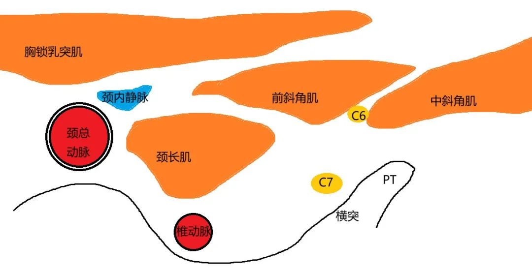 超声引导下颈椎介入技术图谱（一）：C5-7颈神经根