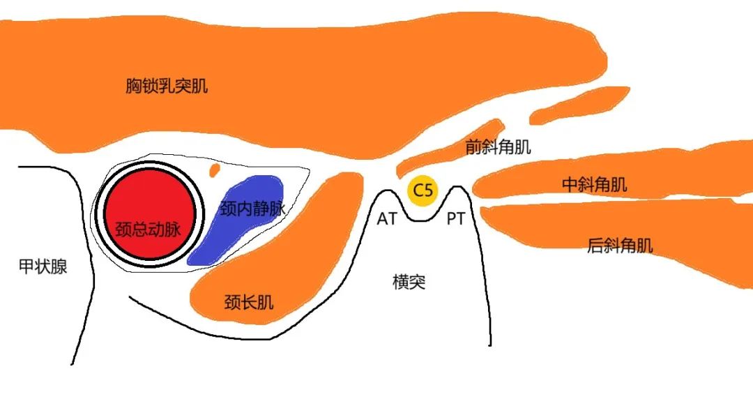 超声引导下颈椎介入技术图谱（一）：C5-7颈神经根