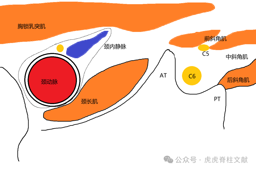 超声引导下颈椎介入技术图谱（一）：C5-7颈神经根