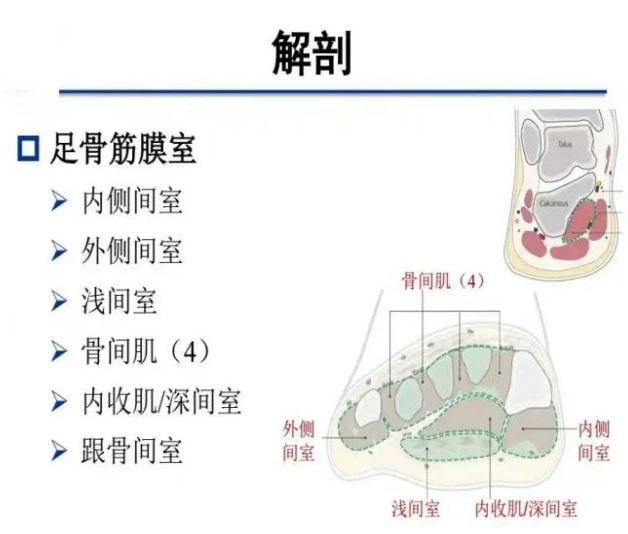 儿童骨筋膜室综合征，你知道什么处理吗？