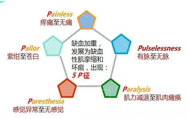 儿童骨筋膜室综合征，你知道什么处理吗？