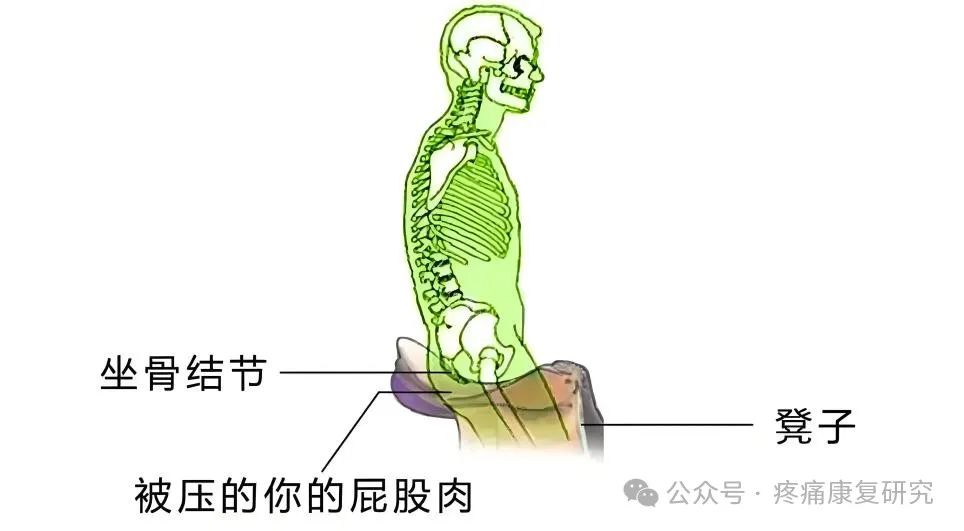 臀部疼痛是咋回事？重点关注这