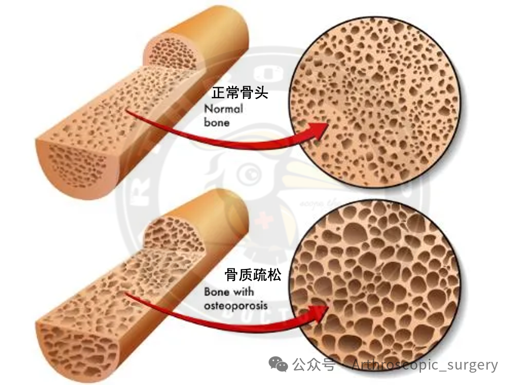 手术技术