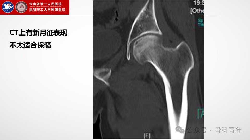 手术步骤