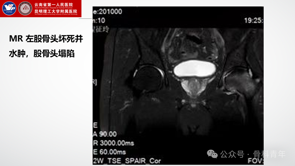 手术步骤