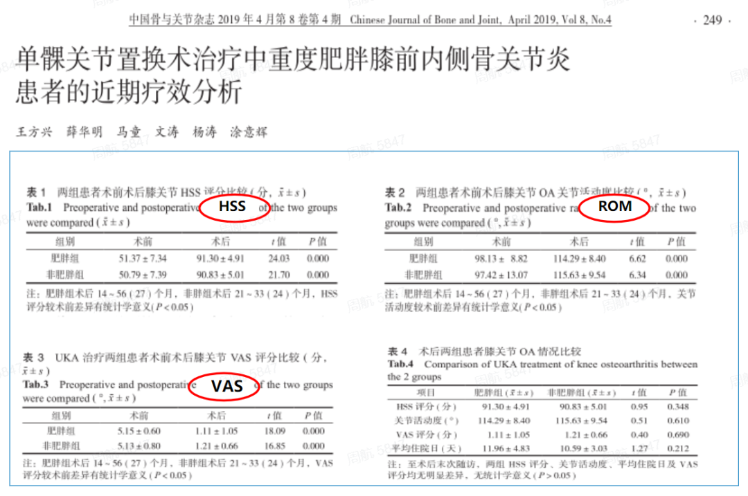 涂意辉教授精讲：固定平台单髁置换术基础理论和实战技巧系列教程