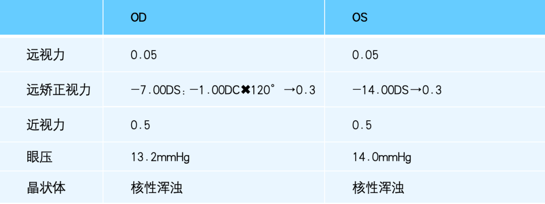 病历分享｜屈光白内障手术-低度近视患者