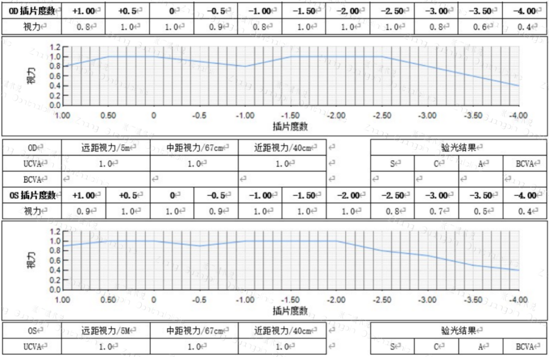 病历分享｜屈光白内障手术-低度近视患者——PanOptix