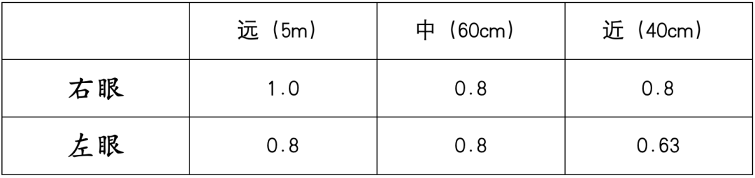 病历分享｜屈光白内障手术-低度近视患者——PanOptix