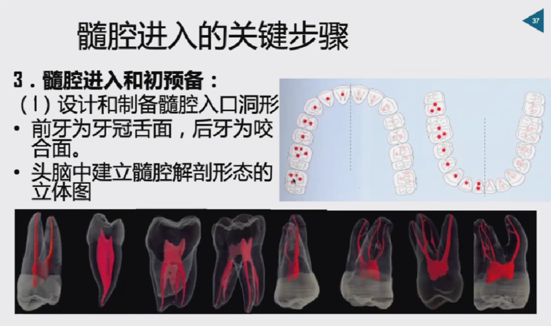 慎始如终：做好根管治疗的第一步